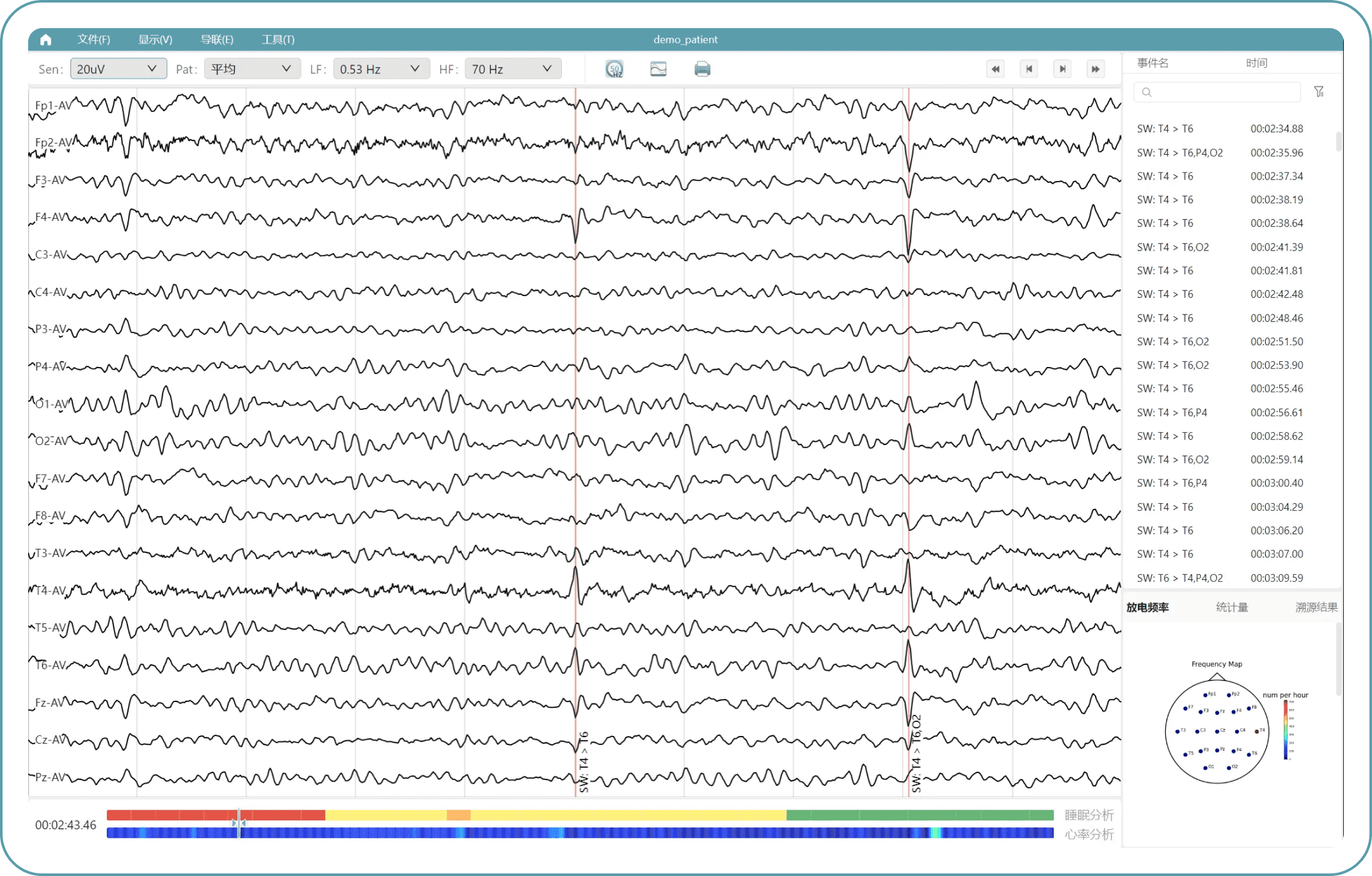 —EEG-X智能脑电分析平台