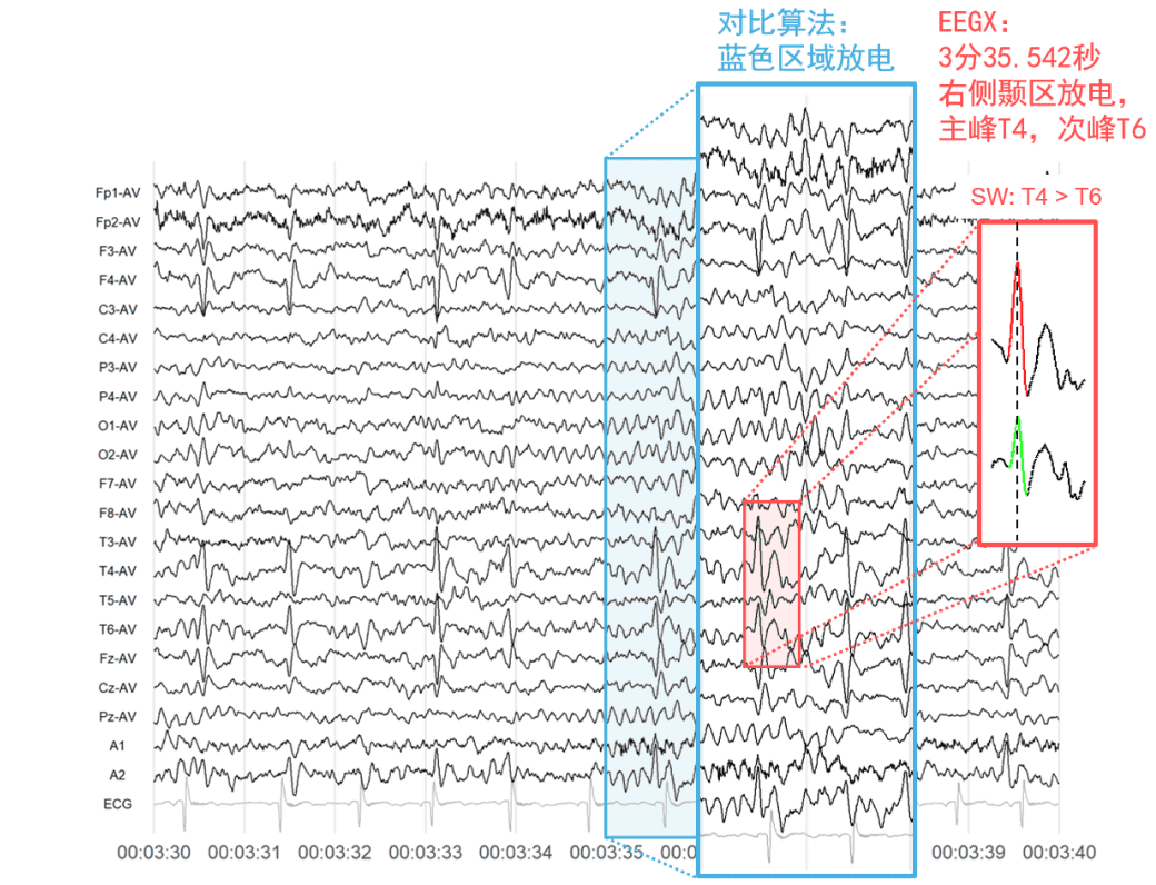 从“有放电”到“哪有放电”