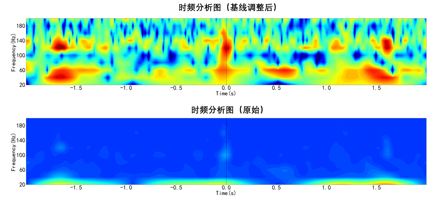 自动基线调整——更准确的时频分析